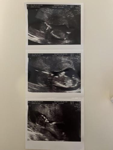 Week 13 Pics